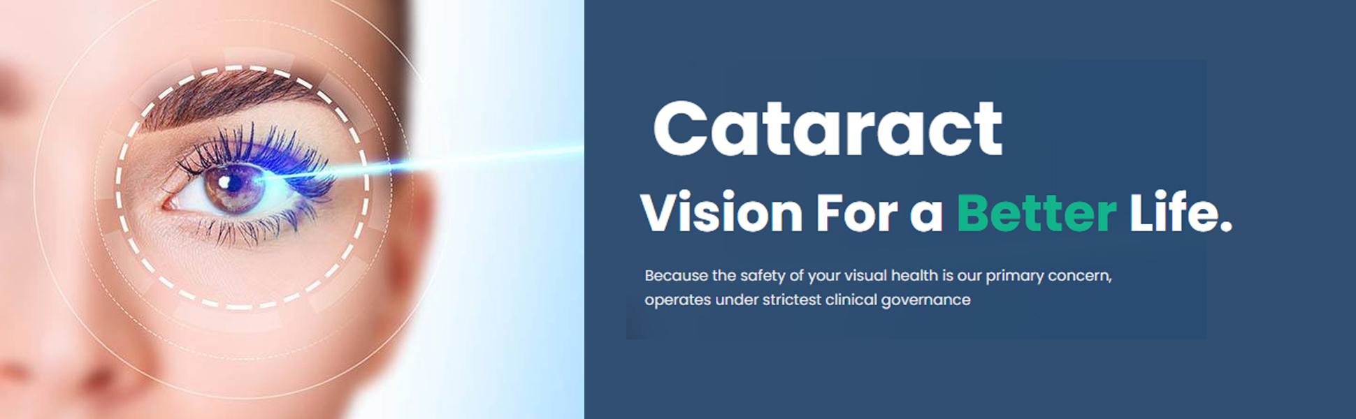 cataract