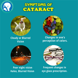 Cataract