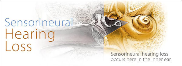 Conductive Hearing Loss
