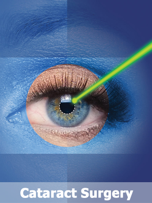 Cataract