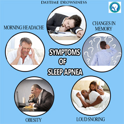 Sleep Apnea