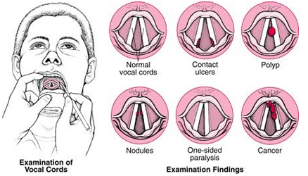Voval Disorders